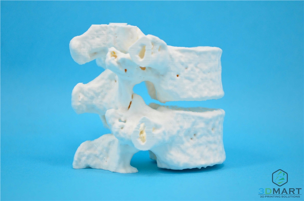 3DMART Ultimaker3 雙噴頭 3D列印機 水溶性支撐溶解  骨頭模型